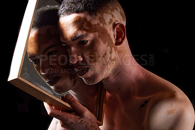 Buy stock photo Vitiligo, beauty and mirror for man reflection of skin condition, disorder or problem with dermatology treatment on black studio background. Pigmentation, patches and melanin of male face for art