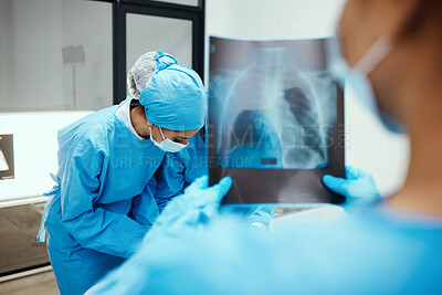 Buy stock photo Xray, body and surgery team in hospital, consulting for cancer tumor healthcare wellness or emergency risk. Nurse, doctor and medical worker for consultation, anatomy research and patient injury 
