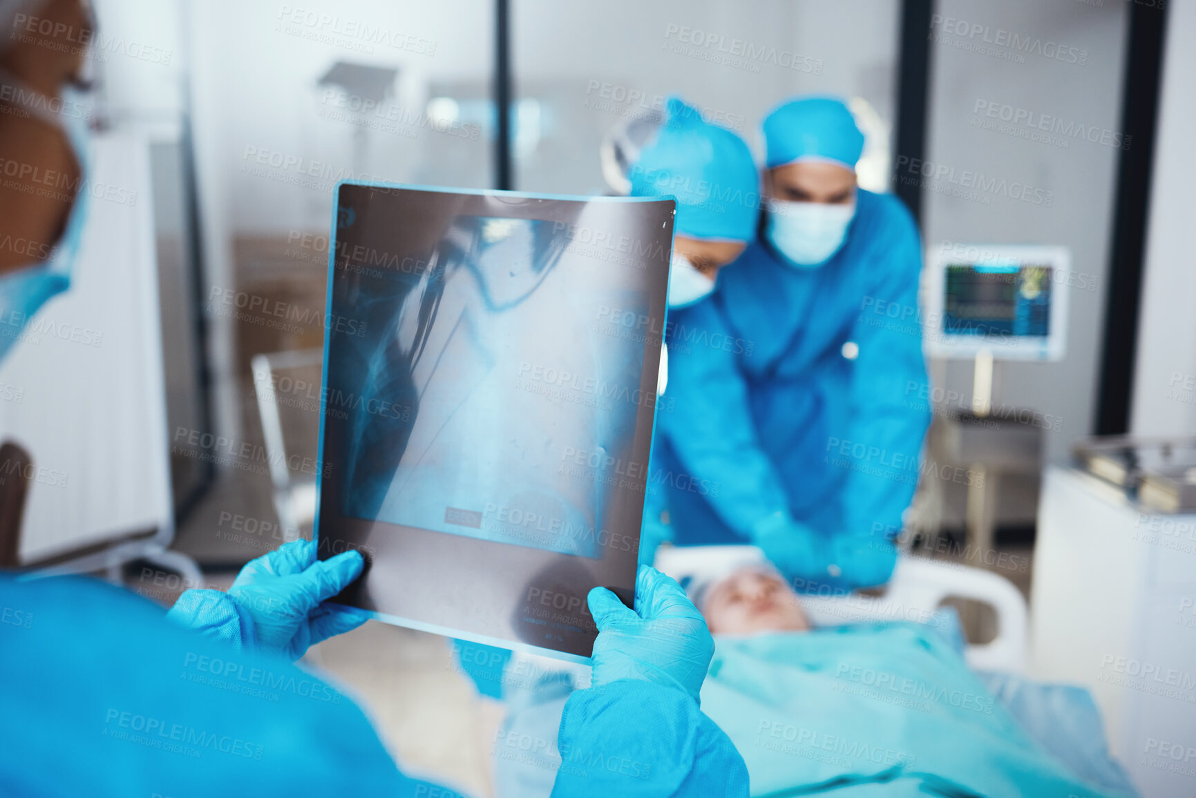 Buy stock photo Team of doctors, x ray and surgery in hospital with patient in stretcher. Teamwork, healthcare and medical professional with mammogram, nurses and surgeons preparing for operation of person in clinic