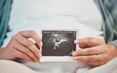 Buy stock photo Pregnancy, love and hands with scan of baby with woman excited for future with family, children and kids. Healthcare,  newborn baby and hand of pregnant woman with 3d image, ultrasound and photograph