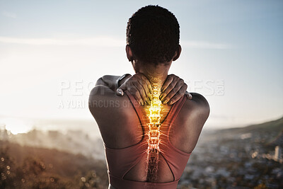 Buy stock photo Exercise, back pain and spine problem of black woman outdoor for fitness workout and running with hands on shoulder overlay and double exposure. Burnout of female athlete with skeleton light injury