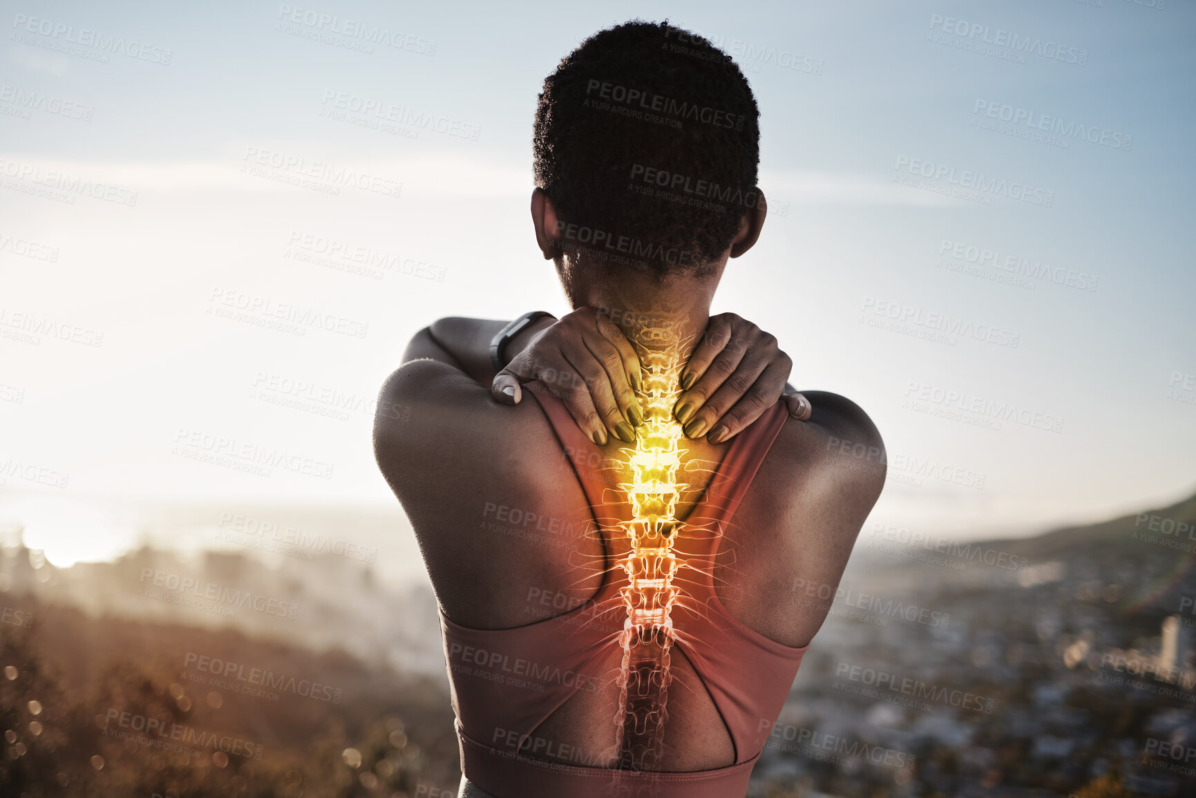 Buy stock photo Exercise, back pain and spine problem of black woman outdoor for fitness workout and running with hands on shoulder overlay and double exposure. Burnout of female athlete with skeleton light injury