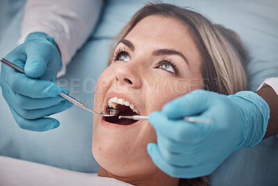 Buy stock photo Dental, teeth and woman at the dentist for a check up, tooth whitening or cavity removal procedure. Dentistry, oral care and hands of a doctor checking the mouth of female patient with medical tools.