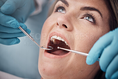 Buy stock photo Teeth, dental or woman at a dentist for surgery, teeth whitening or mouth cleaning for gum disease bacteria. Wellness, tooth decay or hands helping or working with oral tools in healthcare clinic