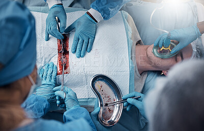 Buy stock photo Top view, teamwork of doctors and surgery of patient in hospital. Healthcare, collaboration and group of people or medical professionals performing a surgical operation on man in operation theater.
