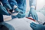 Doctors, nurses or surgery hands on cut patient in hospital emergency room for stomach ulcer, heart attack or burst appendix. Zoom, healthcare workers or surgical operation and steel metal equipment