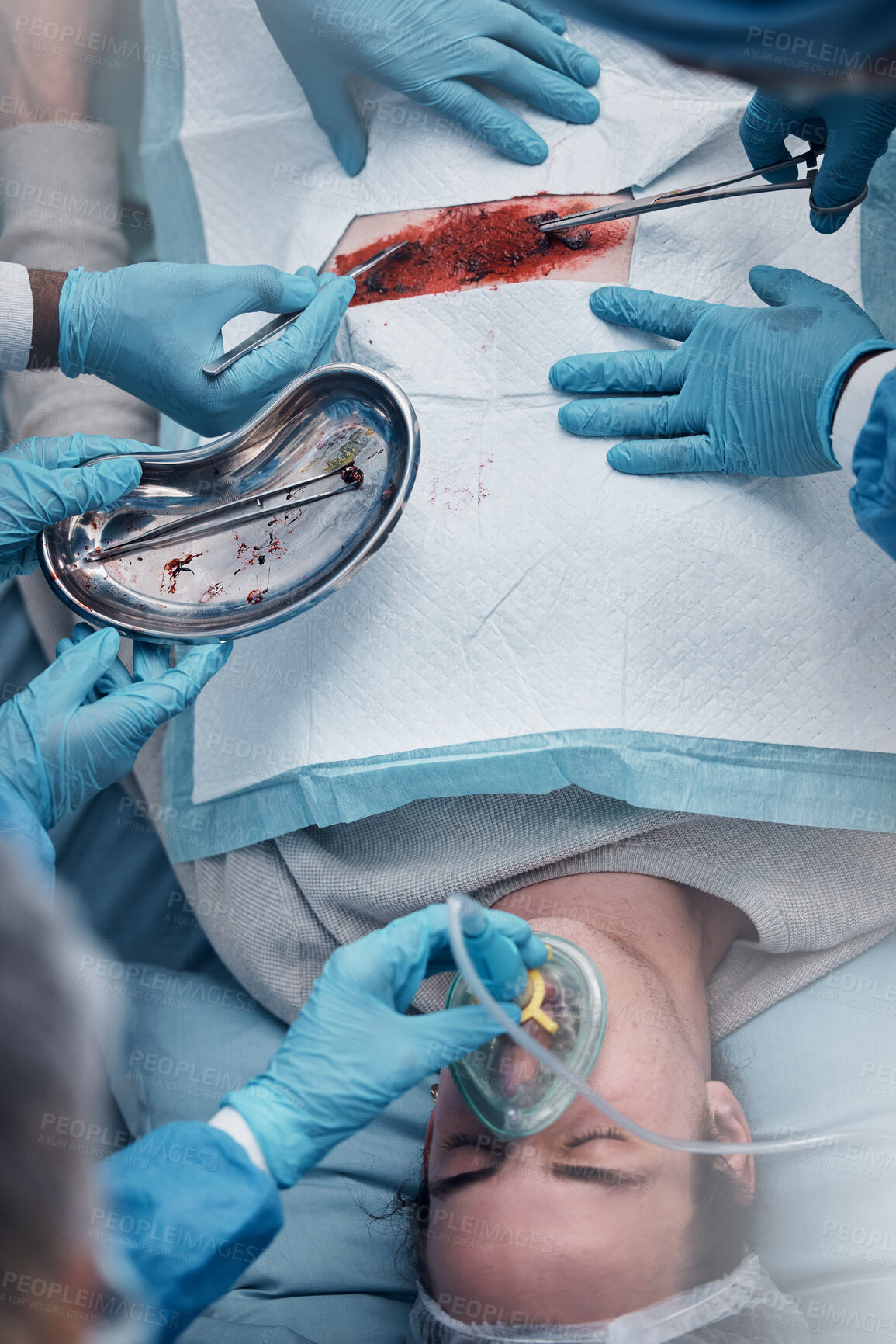 Buy stock photo Doctors, surgery and blood with a medicine team in scrubs operating on a man patient in a hospital. Doctor, nurse and teamwork with a medical group in a clinic to perform an operation