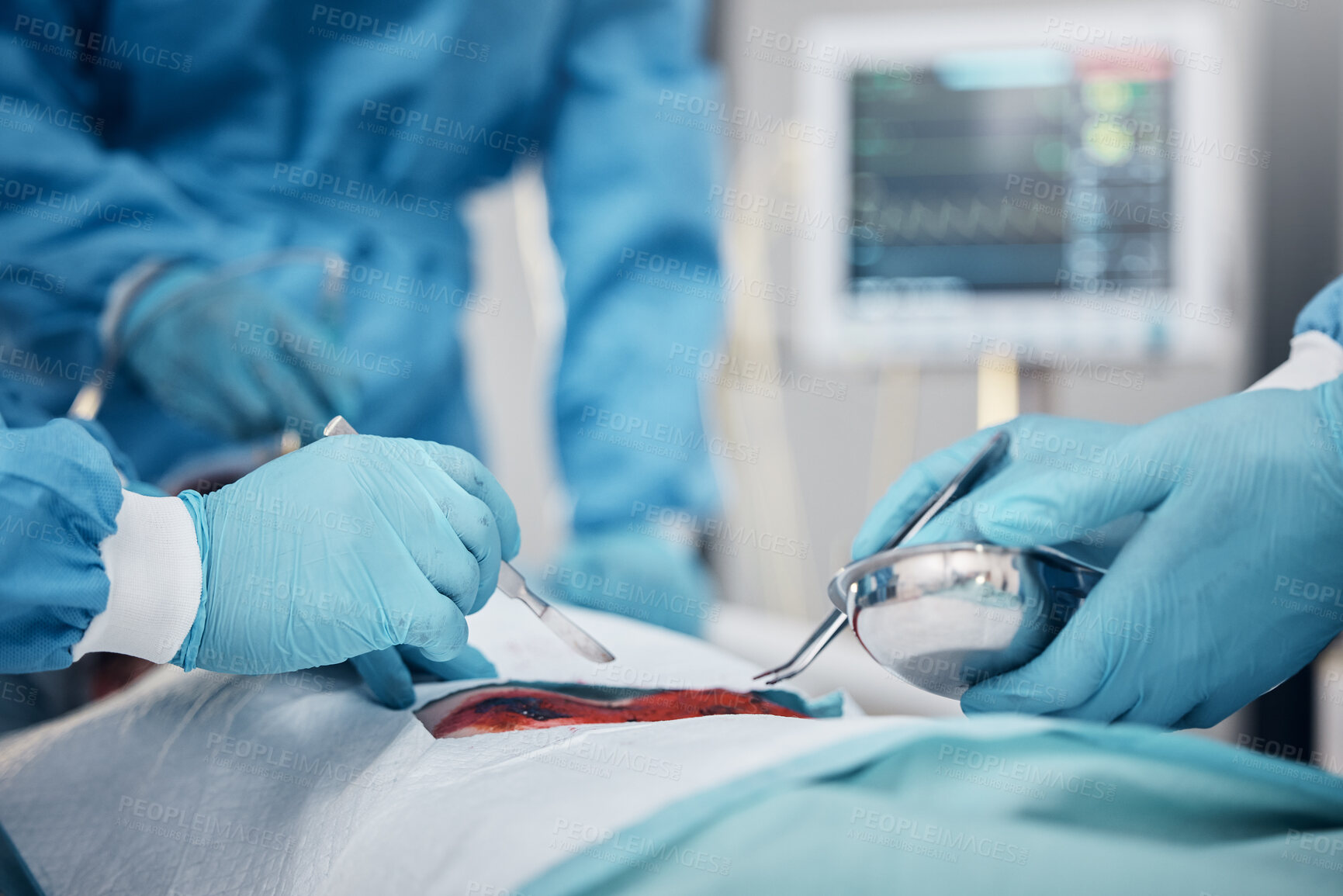 Buy stock photo Hands, blood and operation with a team of doctors at work during surgery with equipment or a tool in a hospital. Doctor, nurse and collaboration with a medicine professional group saving a life
