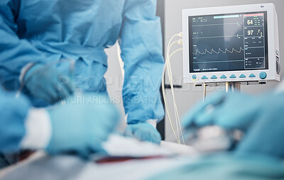 Buy stock photo Hands, monitor and operation with a team of doctors at work during surgery with equipment or a tool in a hospital. Doctor, nurse and collaboration with a medicine professional group saving a life