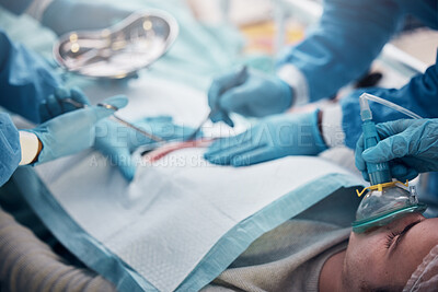 Buy stock photo Doctors, nurses or surgery hands on cut patient in hospital emergency room for stomach ulcer or burst appendix. Zoom, healthcare workers or surgical operation and steel metal equipment