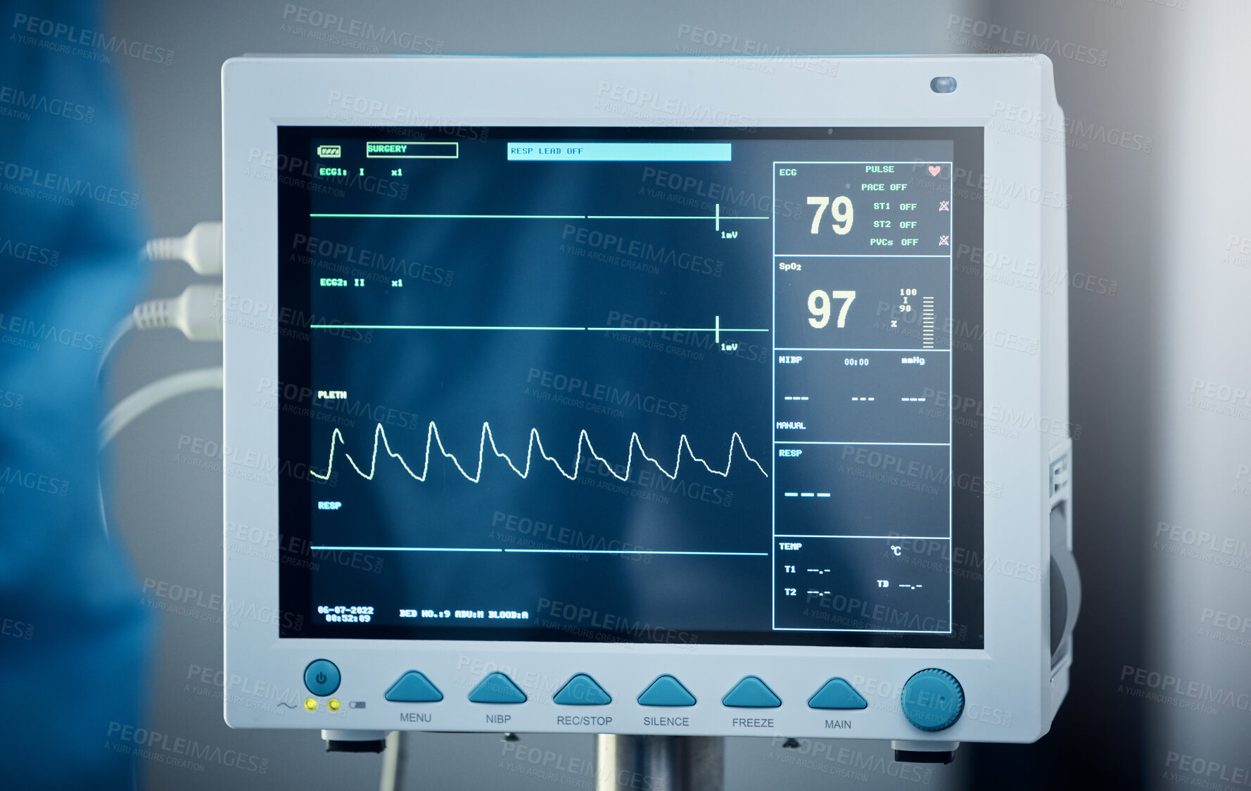 Buy stock photo Healthcare, hospital and electrocardiogram monitor or screen. Medical tool, ecg equipment and heart rate device to measure pulse, heartbeat and electrical activity of heart for cardiovascular health.