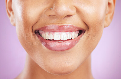 Buy stock photo Happy woman, face or dental care on purple studio background or teeth whitening, invisible braces treatment or grooming. Zoom on beauty model smile or cosmetic mouth hygiene and healthcare cleaning 