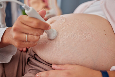 Buy stock photo Pregnant woman, ultrasound and doctor hands with stomach scan for baby healthcare, medical support or gynecology. Pregnancy maternity consultation, hospital and patient abdomen with gynecologist help