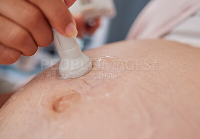 Buy stock photo Doctor hand, ultrasound and pregnancy stomach for reading, health and family planning for future mother. Zoom closeup of medic, pregnant woman and sonogram with medical tech on abdomen for healthcare