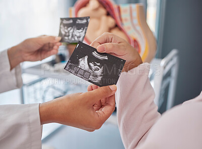 Buy stock photo Doctor, hands and woman with ultrasound photo for fetus growth, development or family planning in clinic. Black woman medic, sonogram picture or healthcare for mother patient at hospital in pregnancy