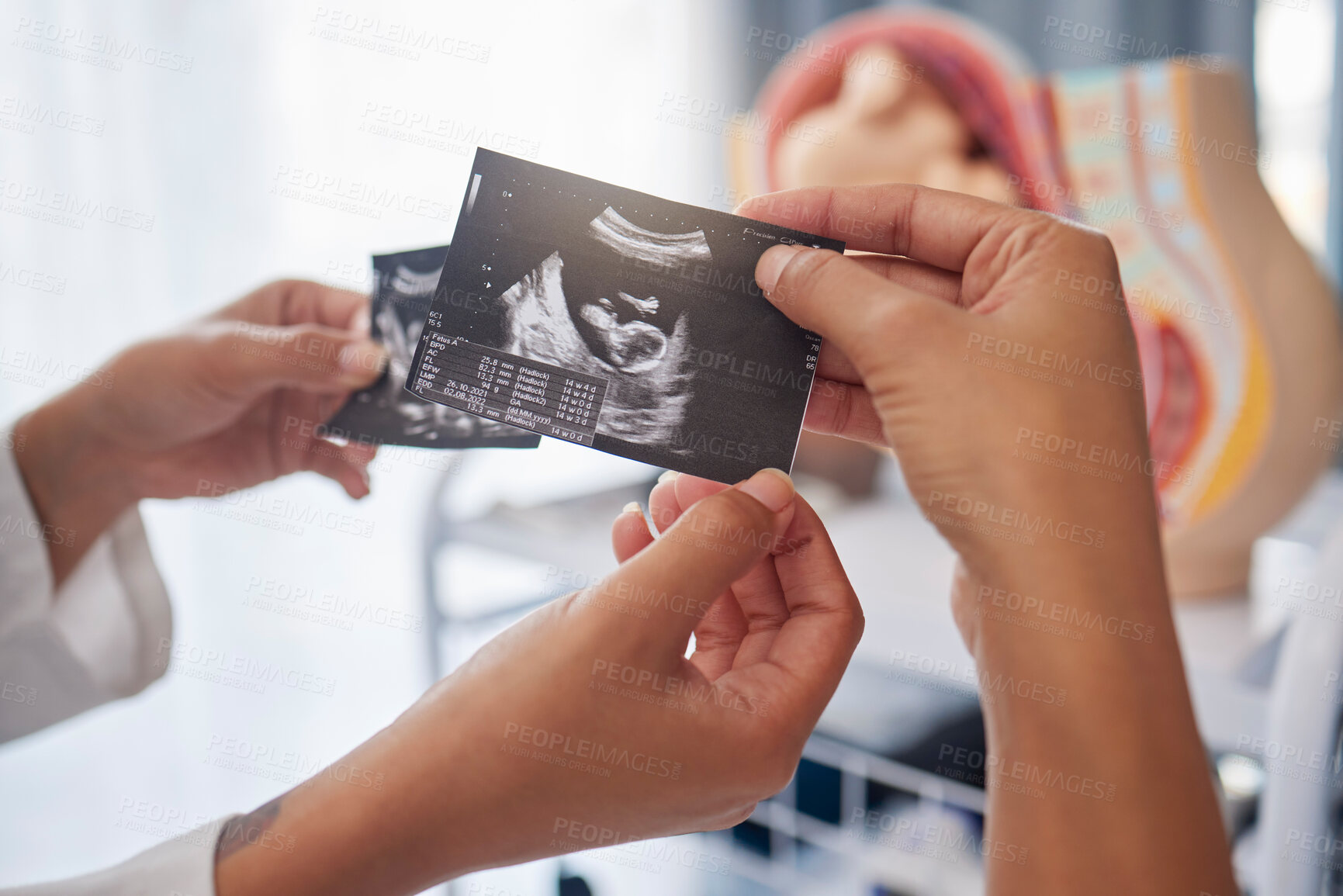 Buy stock photo Sonogram, showing and hands with an ultrasound of a baby from the doctor to mother at a clinic. Consultation, pregnancy and pregnant woman with a picture of a child from a gynecologist at hospital