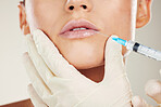 Skincare, mouth and collagen, woman with injection in lips from healthcare professional, anti aging treatment in studio. Beauty, needle and model with facial lip filler syringe on white background.