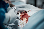 Surgery, blood and doctor hands with medical surgeon scissors for hospital and clinic emergency. Health service, doctors and wellness care of a healthcare worker working on a patient with tools