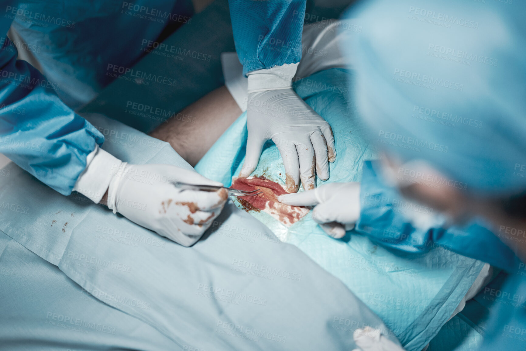 Buy stock photo Surgery cut, nursing and doctor hands with medical surgeon scalpel for hospital and clinic emergency. Health service, doctors above and wellness of a healthcare worker working on a patient with blood