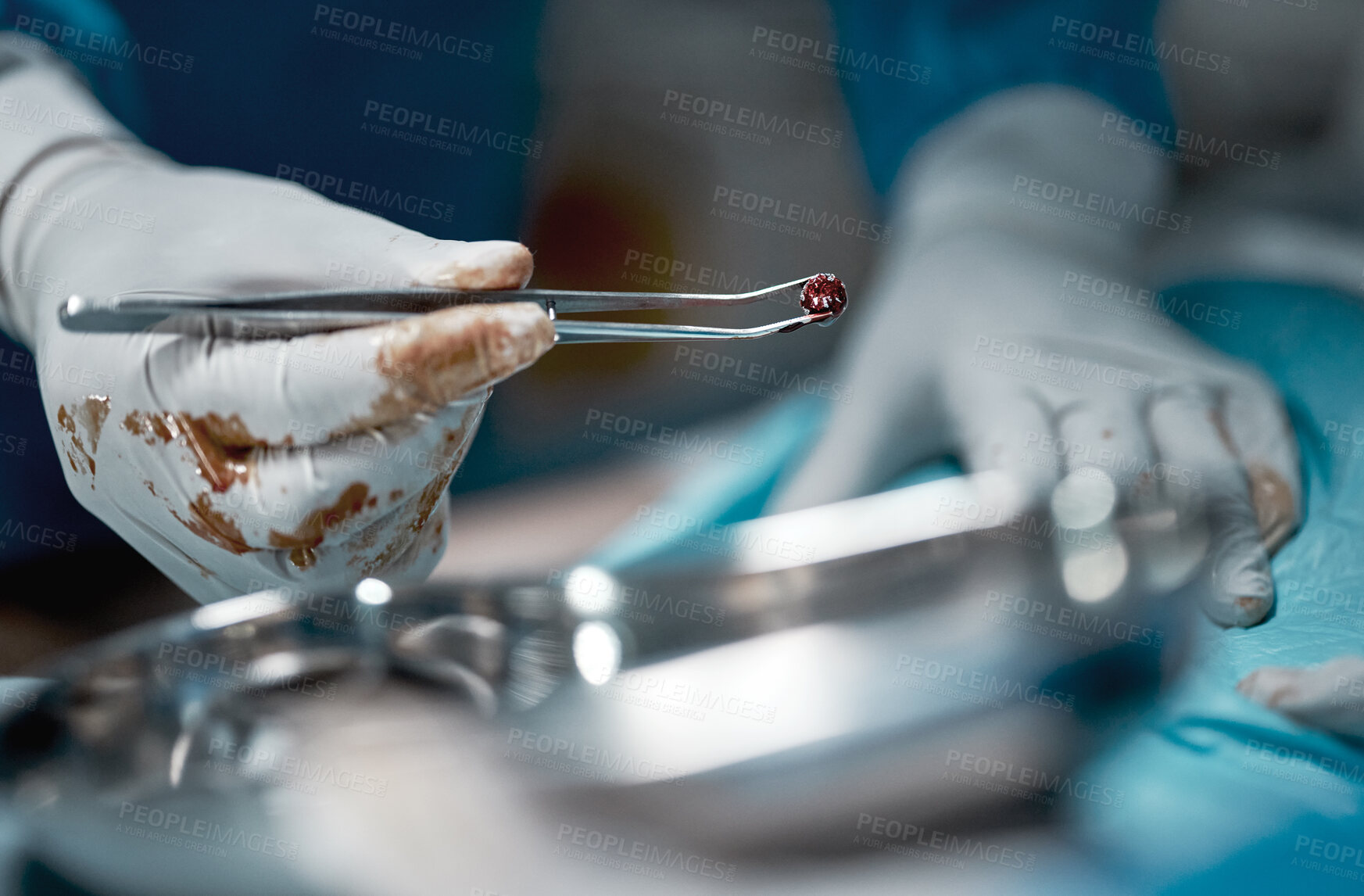 Buy stock photo Surgery, blood and motion blur with the hands of a doctor in a hospital for a medical or life saving operation. Healthcare, emergency or medicine with a surgeon at work in an operating room