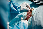 Surgery incision, blood and doctor hands zoom with medical surgeon scissors for hospital emergency. Health service clinic and wellness care of a healthcare worker working on a patient with tools