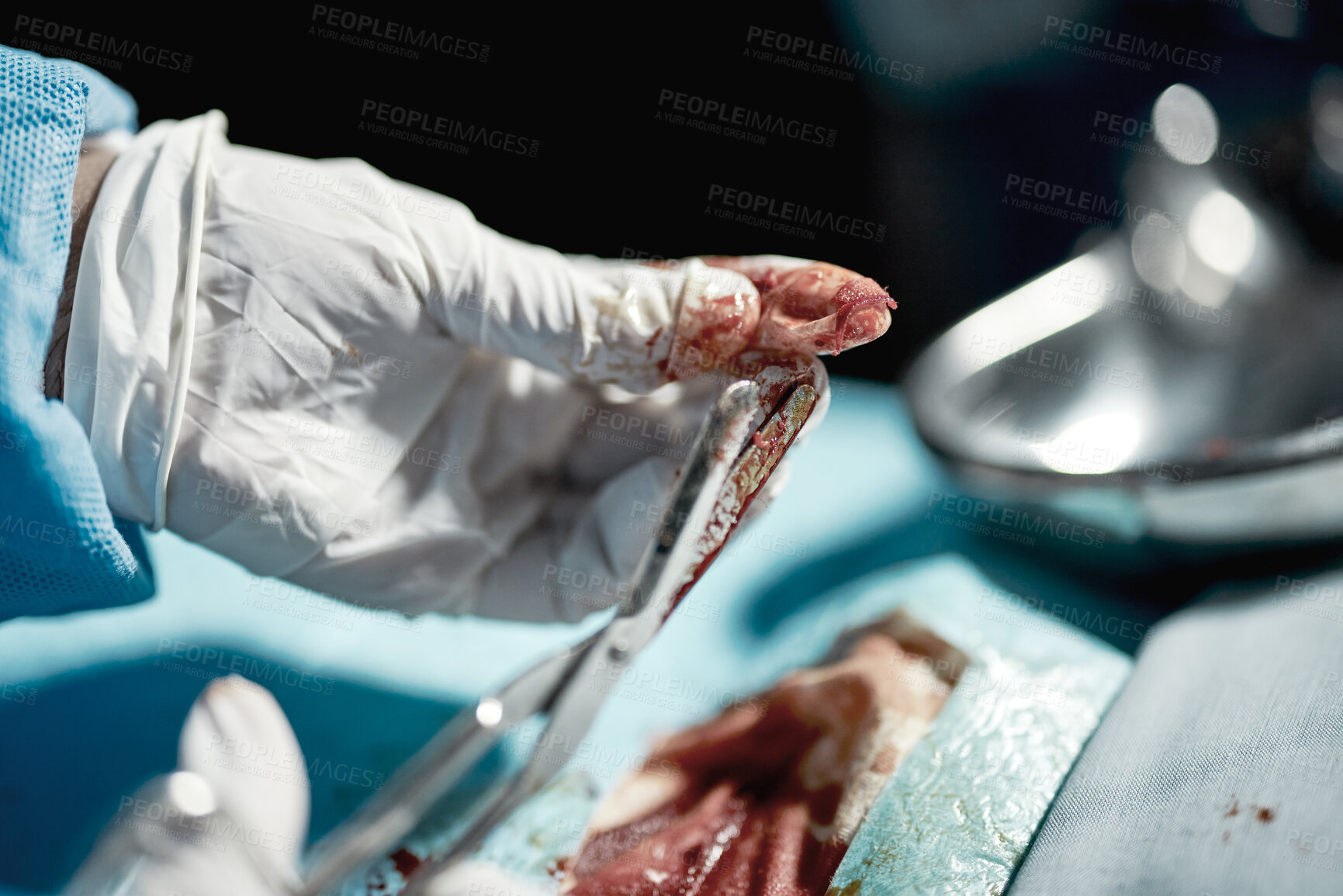 Buy stock photo Surgery wound, doctor hands and medical surgeon scissors with blood at hospital and clinic. Health service help, doctors and wellness care of a healthcare worker working on a patient with tools