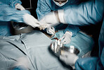 Hands, motion blur and surgery with doctors in a hospital emergency room for a life saving operation. Nurse, teamwork and medical with a doctor and team working in a clinic to save a critical patient