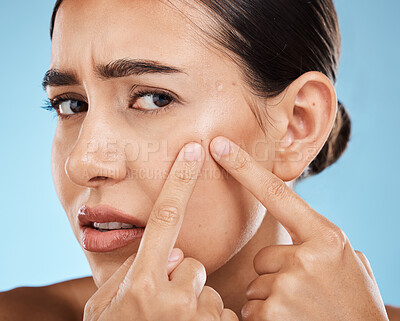 Buy stock photo Woman, face and pop pimple with acne, anxiety and stress, beauty and skincare isolated on blue background. Skin problem, facial zoom and cosmetics in portrait, dermatology and cosmetic care in studio