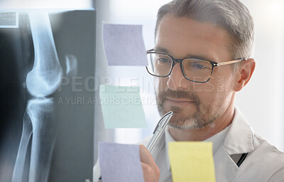 Buy stock photo X ray, analysis and doctor thinking of healthcare solution, problem solving and surgery strategy in office glass. Planning, schedule or radiology in medical anatomy of expert or professional person