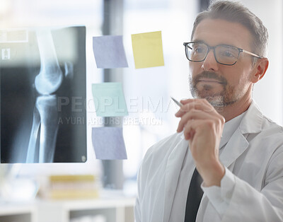 Buy stock photo X ray, analysis and doctor writing healthcare research, solution and focus, vision or strategy of skeleton on glass. Planning, schedule and radiology person or professional in medical anatomy career