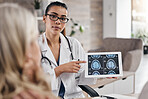 Neurology, woman and doctor pointing at tablet, mri brain scan or xray diagnosis for cancer. Healthcare, advice and patient in doctors office, help consulting on health problem for hospital treatment