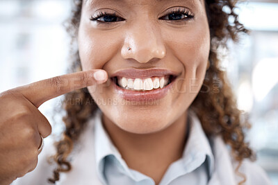 Buy stock photo Face of black woman pointing to her teeth whitening results, dentist medical and mouth healthcare in hospital. Professional dental doctor with tooth cleaning services and happy portrait in USA clinic