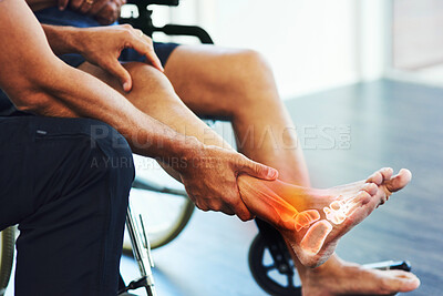 Buy stock photo Rehabilitation, physiotherapist and help a patient with foot injury, pain and muscle tension recovery. Physiotherapy, male or doctor assist with strain, movement or wellness with person in wheelchair