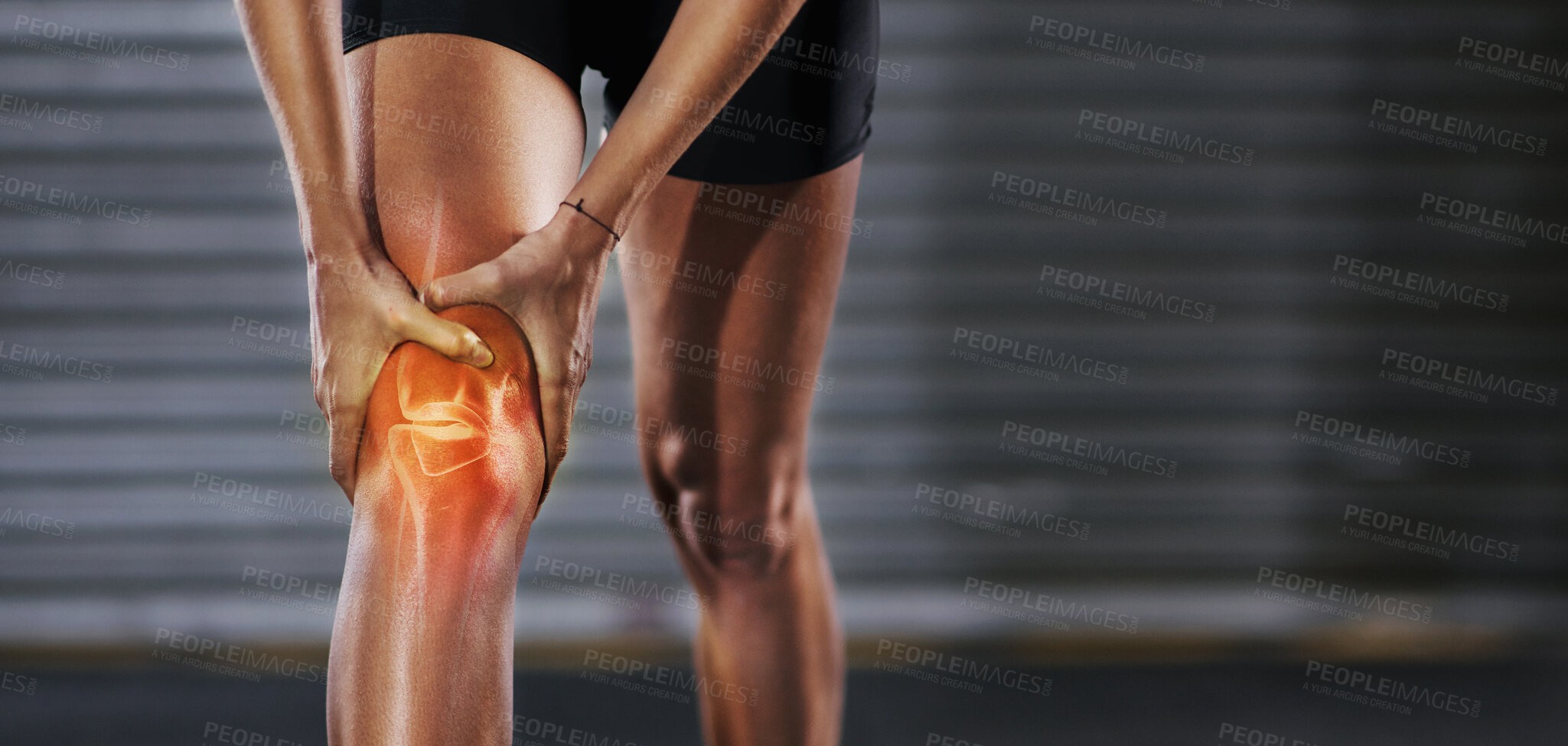 Buy stock photo Knee injury, red muscle and man exercise with medical pain, body strain and sports emergency. Legs, wound and fitness accident from workout, arthritis and skeleton anatomy for orthopedic first aid