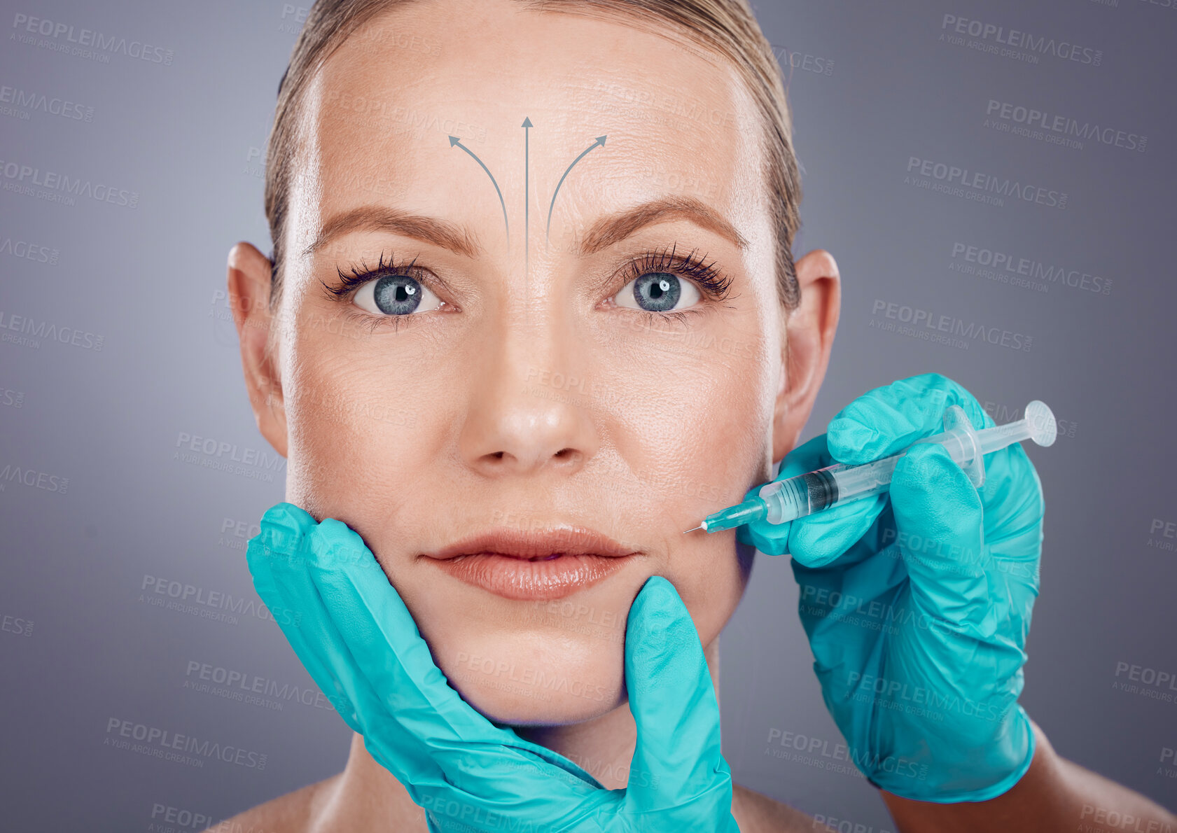 Buy stock photo Plastic surgery, beauty and portrait of woman with injection for lip filler, cosmetics and botox in studio. Skincare, dermatology and girl with needle for anti aging, face lift and facial treatment