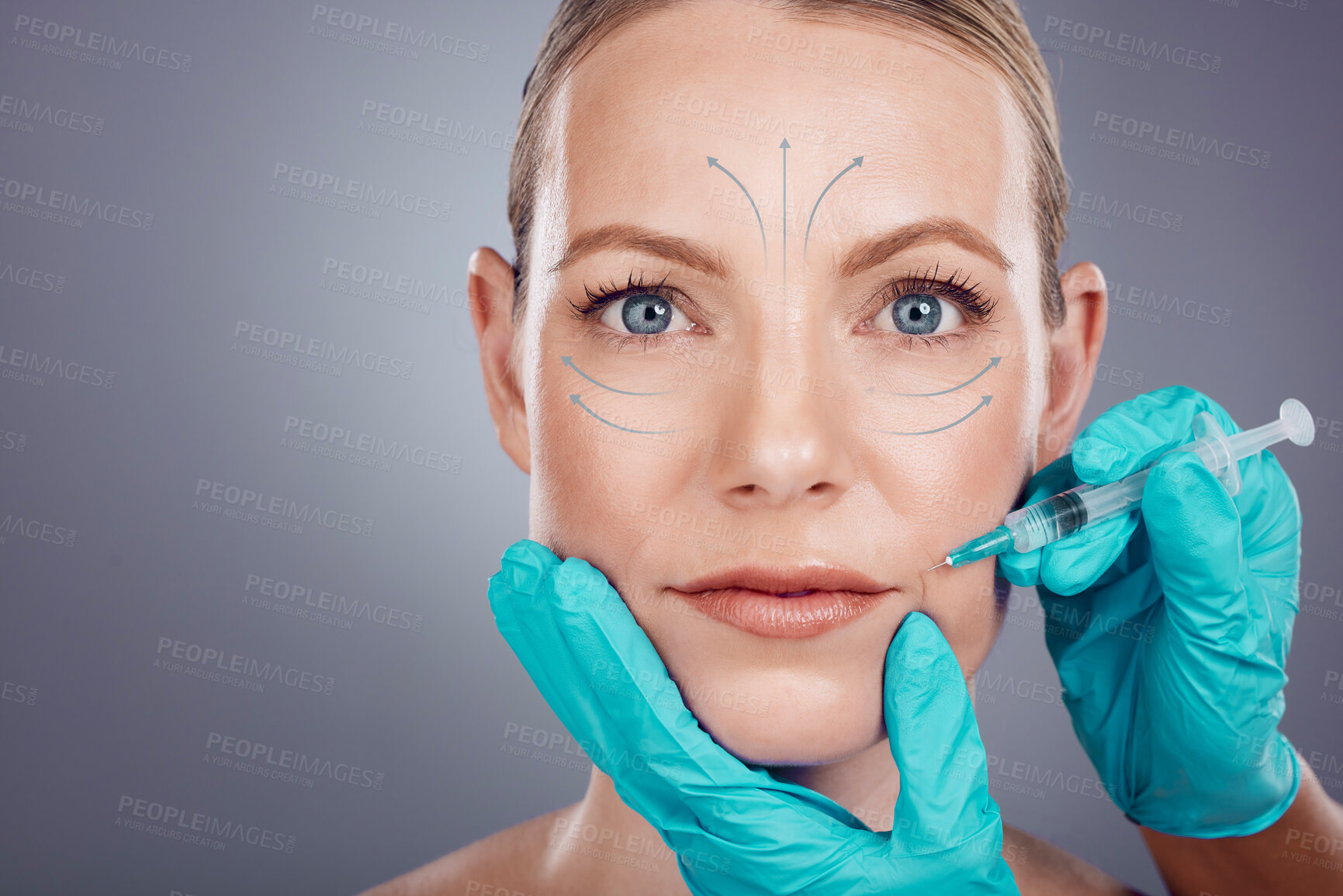 Buy stock photo Woman, studio portrait and lip filler injection for plastic surgery, cosmetics and beauty by gray background. Model, anti aging and headshot with skincare, writing and face transformation by surgeon