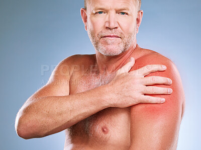 Buy stock photo Sunburn, skincare and portrait of a man with red skin color and burn texture in studio. Isolated, blue background and male model looking for wellness, health and soothing solution for body problem