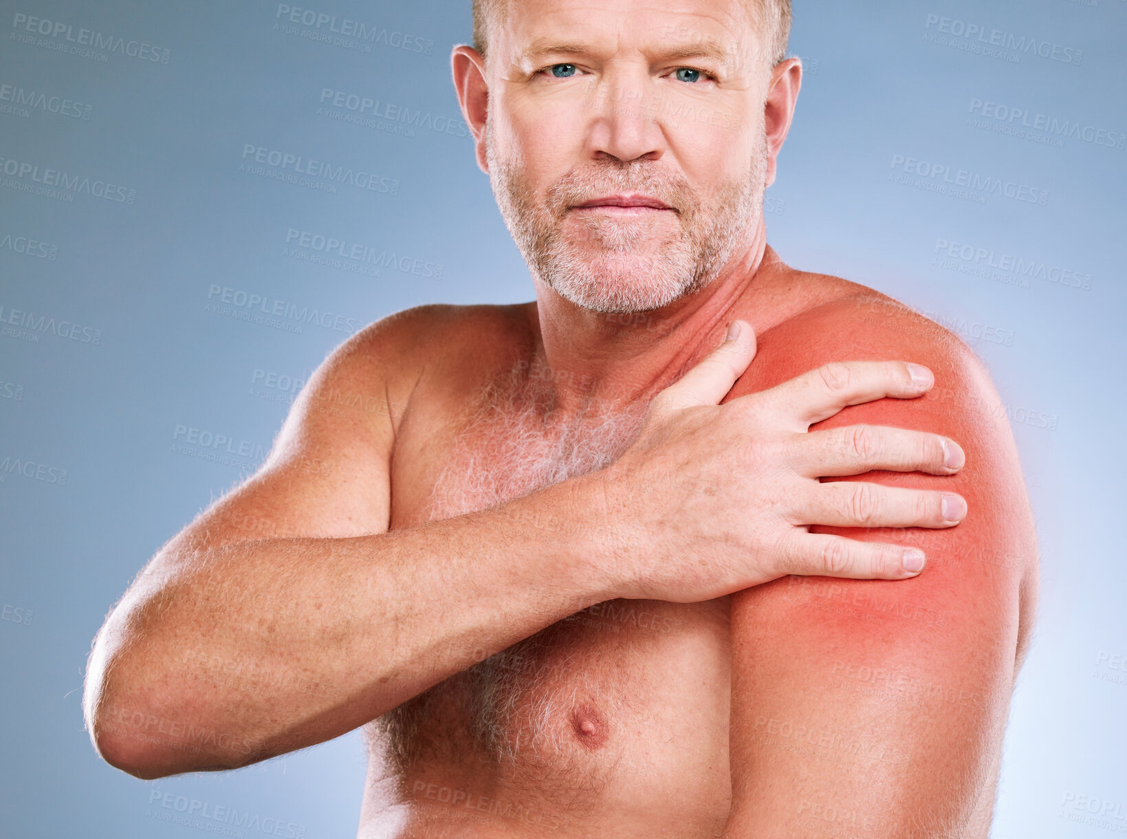 Buy stock photo Sunburn, skincare and portrait of a man with red skin color and burn texture in studio. Isolated, blue background and male model looking for wellness, health and soothing solution for body problem