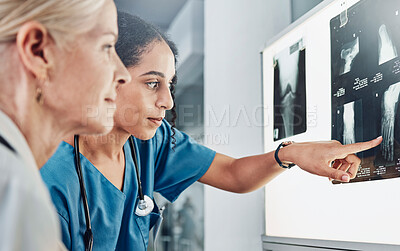 Buy stock photo Medical, x ray and surgery with doctors planning in meeting for leg scan, strategy or research. Medicine, consulting and radiology image with healthcare surgeons for diagnosis, treatment or operation