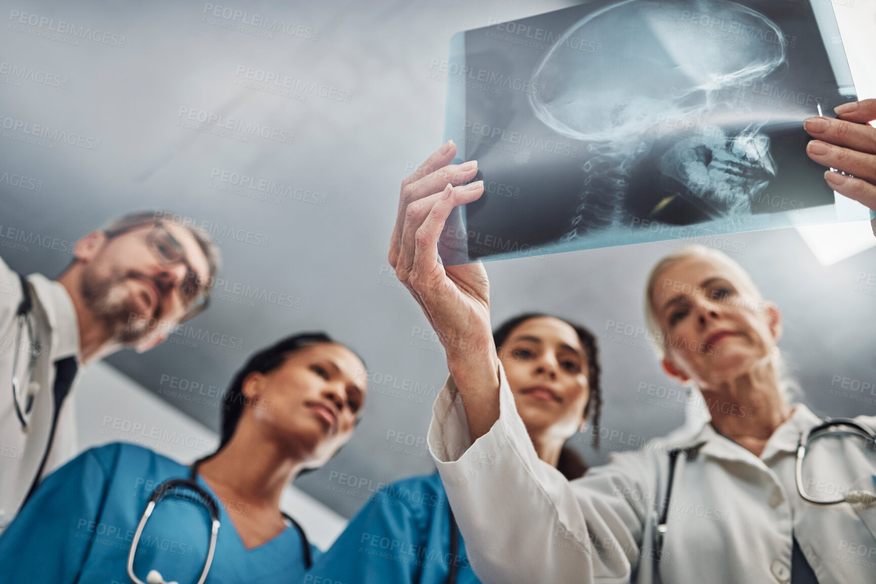 Buy stock photo Xray, doctors and nurses, team and healthcare, analysis of skull scan and neurology medical group. Surgeon, collaboration and results with health, head trauma with medicine and prepare for surgery