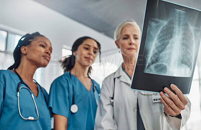 Xray, doctor and nurses, team and medicine with analysis of lung scan and cardiology medical group. Surgery, collaboration and results with healthcare, focus with health and prepare for surgery