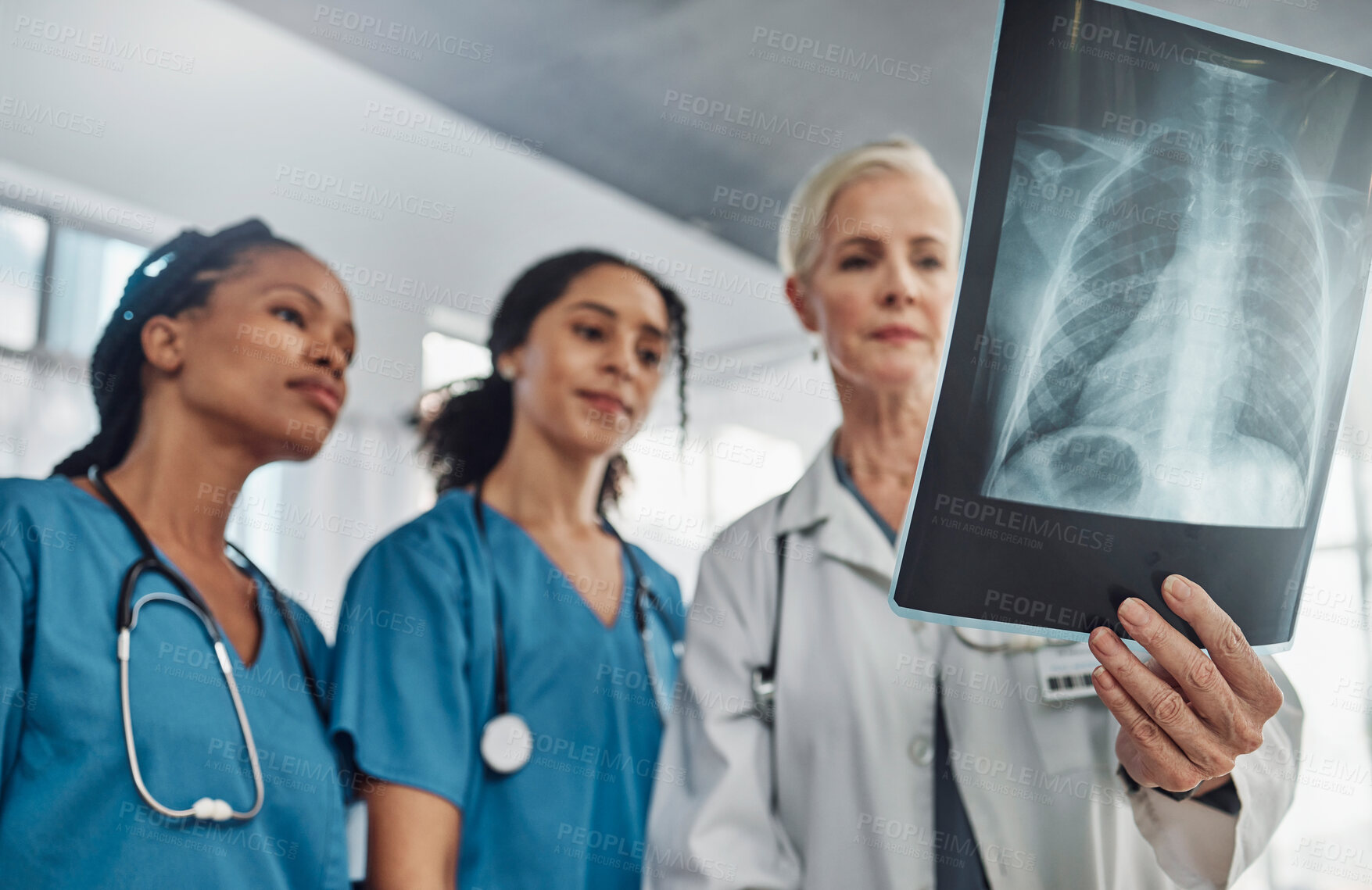 Buy stock photo Xray, doctor and nurses, team and medicine with analysis of lung scan and cardiology medical group. Surgeon, collaboration and results with healthcare, focus with health and prepare for surgery