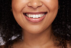 Black woman, teeth and smile for dental care, whitening or oral and mouth treatment. Closeup of happy African American female model smiling for dentist results, healthcare or clean tooth hygiene