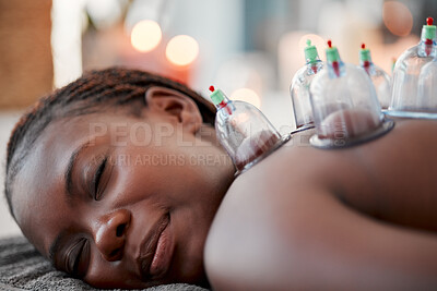 Buy stock photo Black woman, face and smile in cupping therapy on back for pain relief, relaxation or blood flow at resort. Happy African American female smiling in relax for glass vacuum cups in deep tissue massage