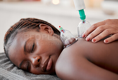 Buy stock photo Black woman, hands and cupping therapy on back in spa for pain relief, blood flow and relaxation at resort. Hand of therapist with glass vacuum cups on African American female in deep tissue massage