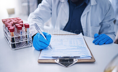 Buy stock photo Blood test, science documents and hands in laboratory for healthcare results, research or review development. Scientist, medicine and writing medical results of dna investigation, paperwork or report