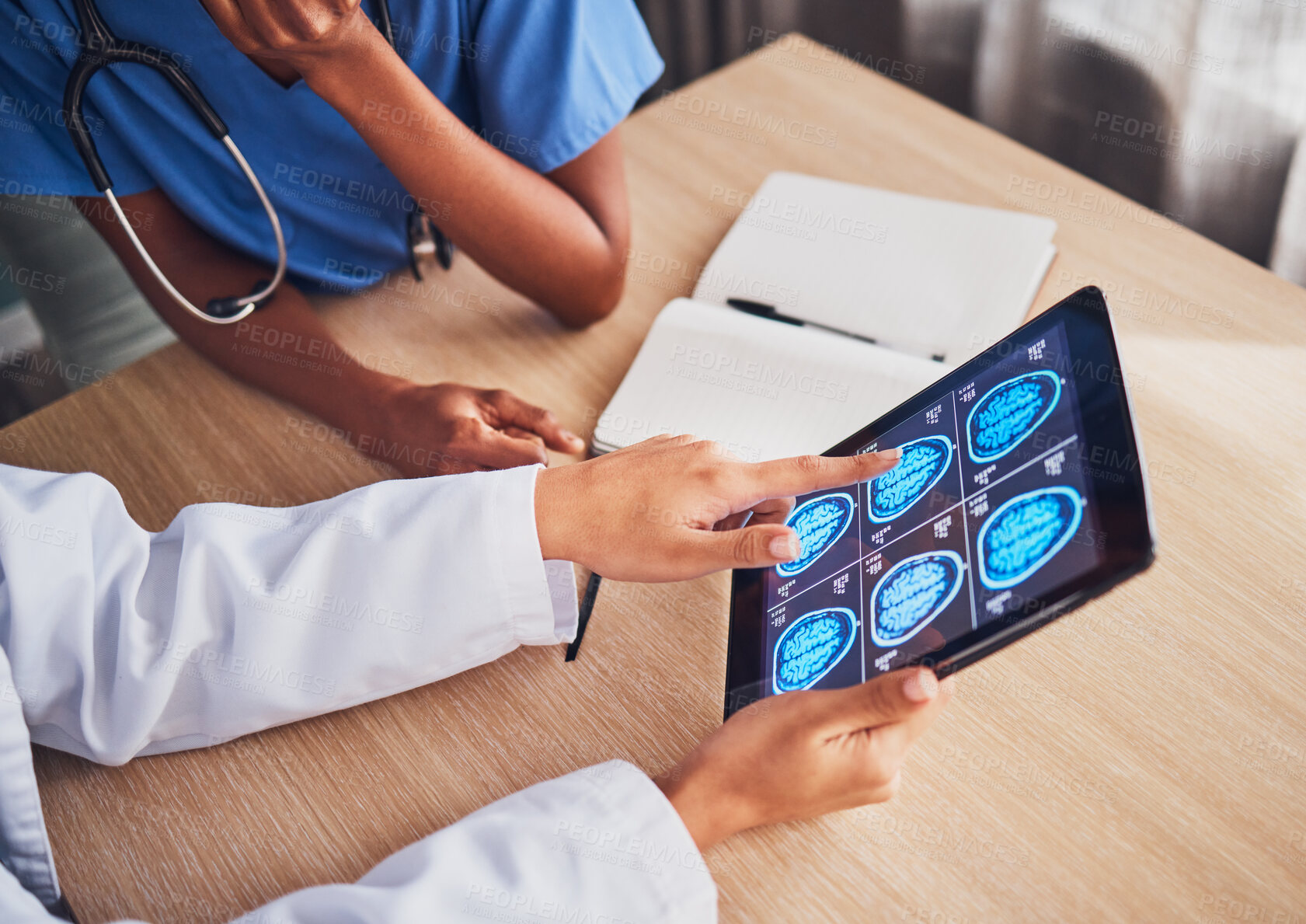 Buy stock photo Doctor, tablet and brain xray, neurology and digital test results, people and healthcare team in hospital. MRI, technology and screen in hands, cancer and radiology, anatomy and health assessment