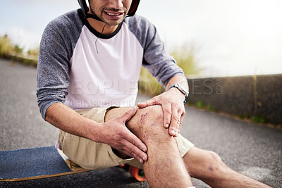 Buy stock photo Injury, man and knee pain after skateboarding accident, practice and learning to skate. Active, bad and skateboarder with a bruise, broken bone or holding a painful leg in the street while skating