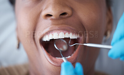 Buy stock photo Checkup, teeth and woman with a dentist for oral hygiene, cavity check or cleaning mouth. Zoom, dental and doctor with mirror to look at the tooth of a girl for healthcare, treatment and examination