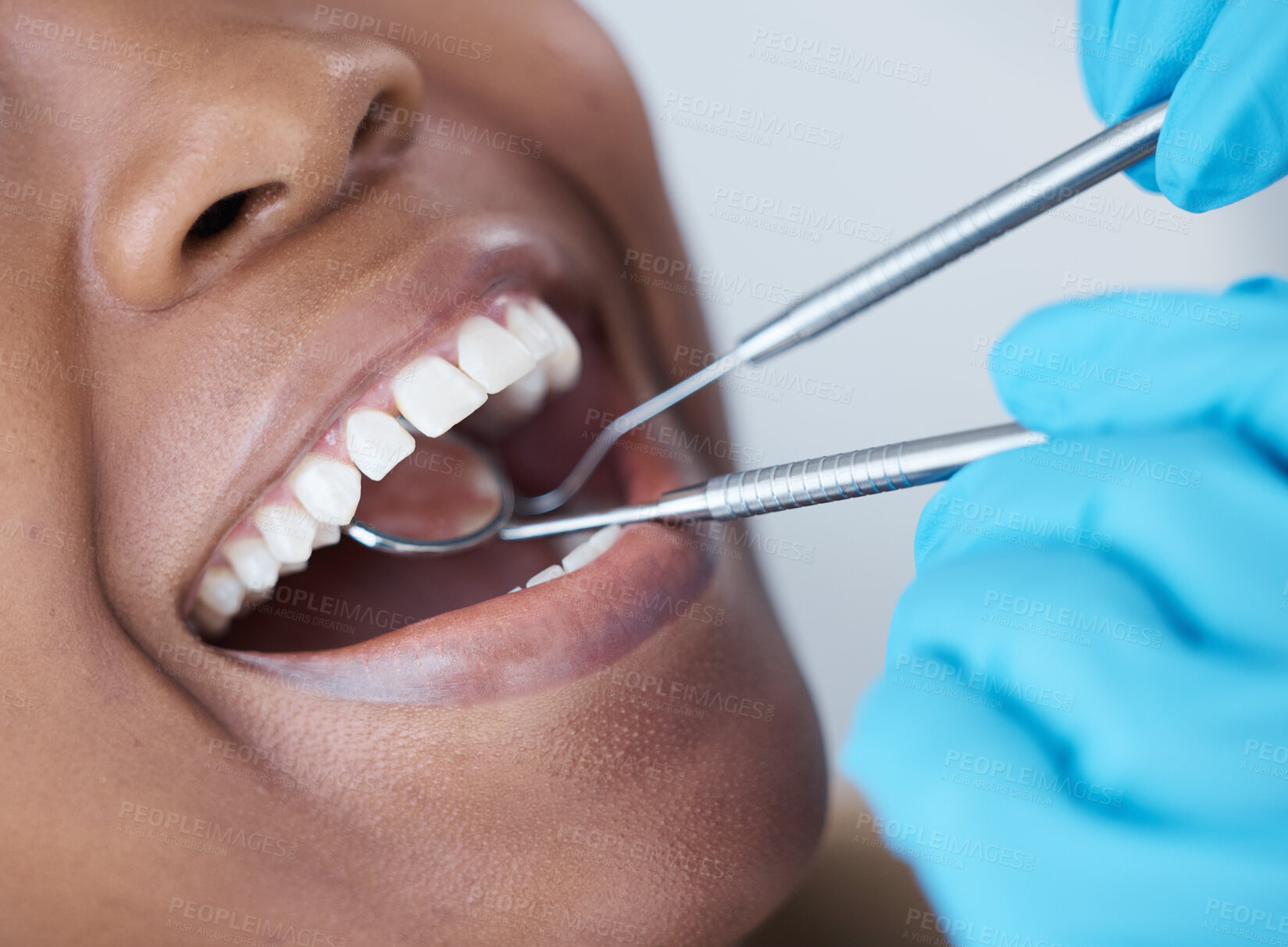 Buy stock photo Checkup, mouth and woman at the dentist for dental care, healthcare and search for cavities. Mirror, healthy and doctor looking at the teeth of a patient for treatment, oral hygiene and surgery